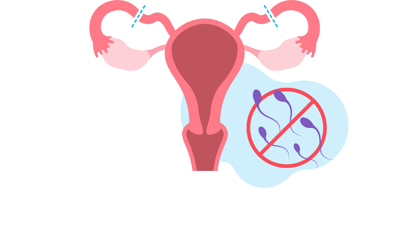 Contraception