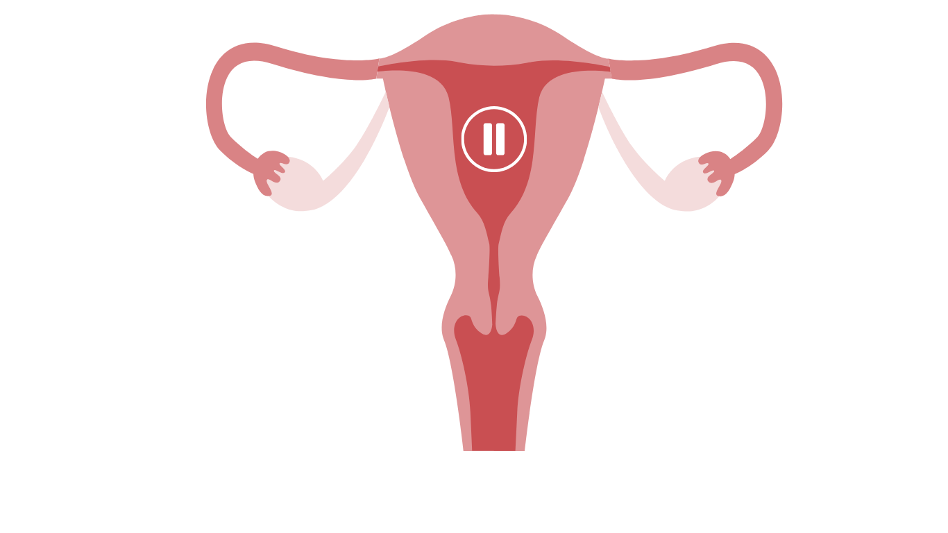 Menopause