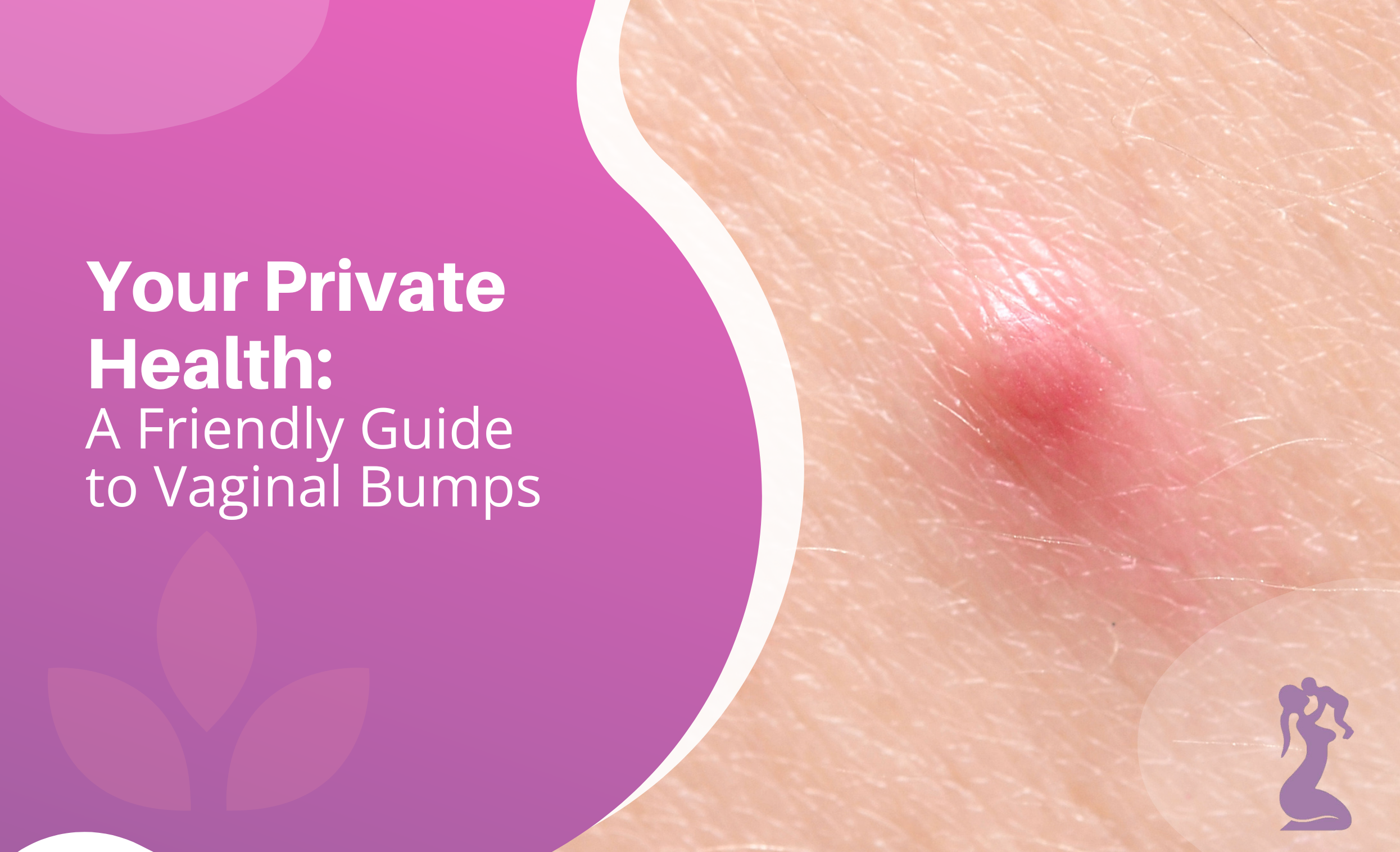 Your Private Health A Friendly Guide To Vaginal Bumps Your Private Health A Friendly Guide To Vaginal Bumps