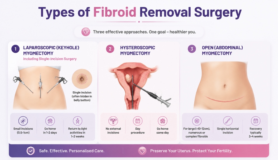 Types of fibroid removal surgery